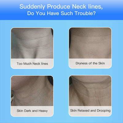 Double Chin Face Lifting Devices